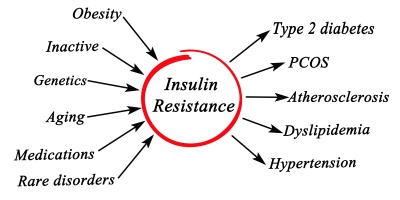 Connection Between Diabetes, Insulin Resistance, and PCOS