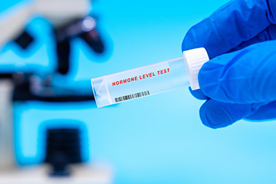 Hormone Level Testing | Atlanta, Alpharetta, Dunwoody & Kennesaw